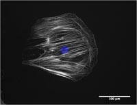 Nanokicking stem cells 1