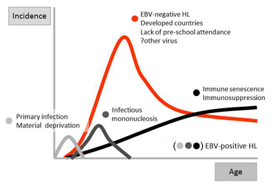 four disease model of Hodgkin lymphoma