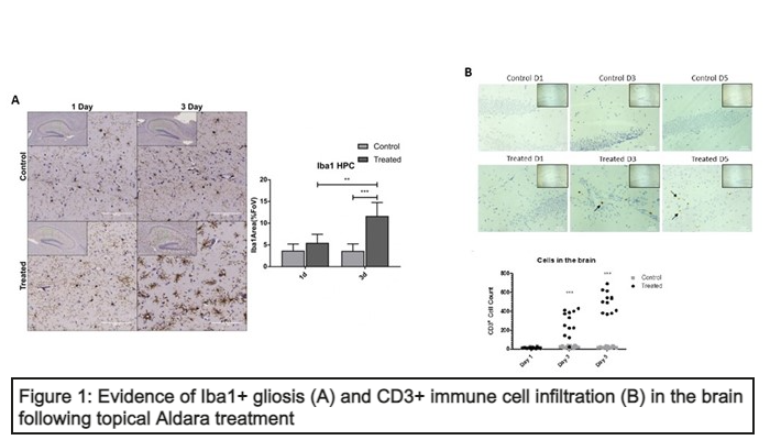 Figure 1. Evidence of Iba1+ gliosis (A) and CD3+ immune cell infiltration (B) in the brain following topical Aldara treatment.